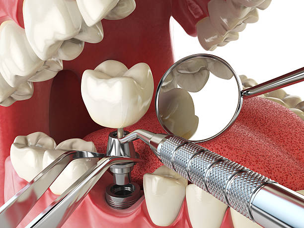 Best Urgent Dental Care in San Andreas, CA