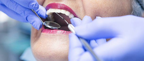 Best Emergency Treatment for Toothache in San Andreas, CA